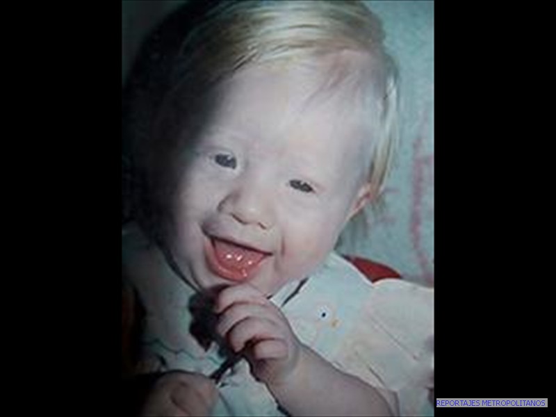 Rubí nació albina